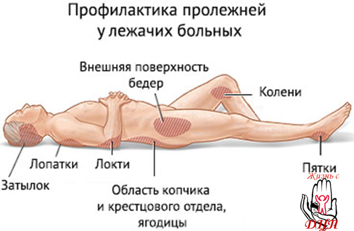 ПСИХОЛОГИЧЕСКИЕ ПРИЧИНЫ НЕУСПЕВАЕМОСТИ МЛАДШИХ ШКОЛЬНИКОВ Нехватка воздуха, Гипервентиляционный синдром