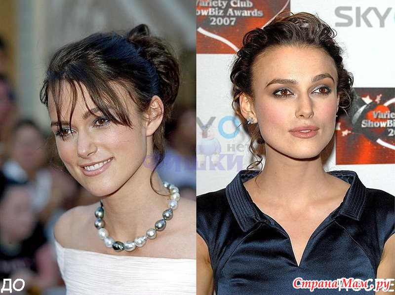 Знаменитости до и после пластической операции фото до и после