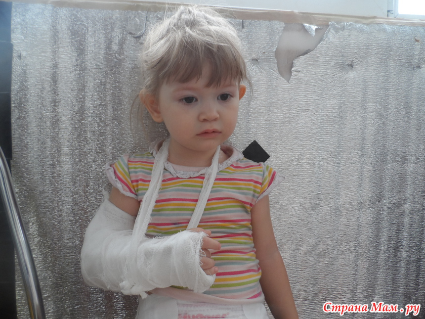 Мать сломала руки ребенку. Маленькая девочка со сломанной рукой.