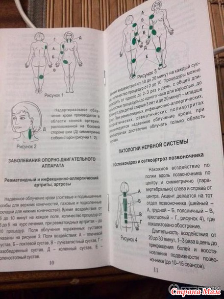 Информационный-геска -лечение артрита, артроза и не только