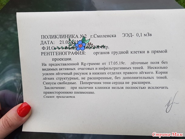 Вопрос про прием антибиотиков ребенком.